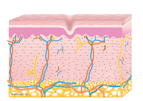Caollagen Remodeling serivce image of how Caollagen Remodeling works