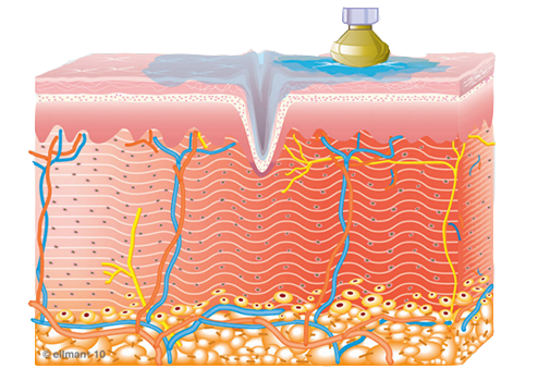 Collagen Service Winnipeg Image of how Collagen Synthesis Begins