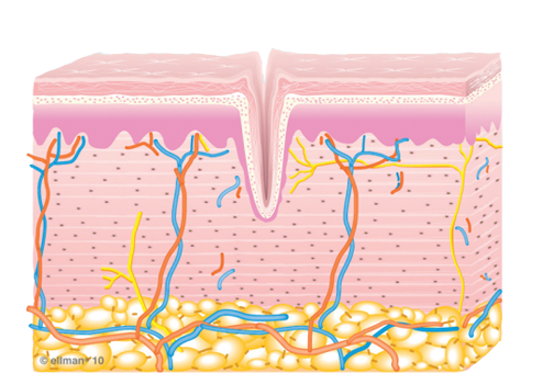 Untreated Skin Image of Untreated Skin