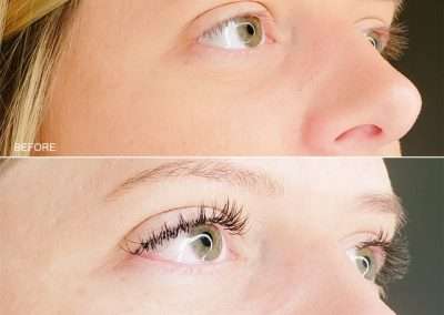 before and after classic lash extension treatment