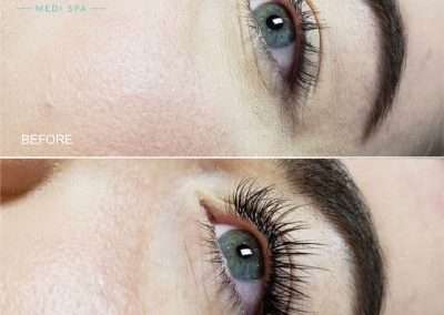 before and after comparison of hybrid lash extension treatment