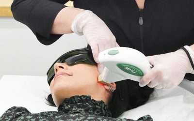 The Science Behind a Photofacial in Winnipeg: Clear Your Skin
