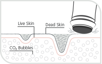 oxygeneo facial OxyGeneo Exfoliate treatment diagram how it works