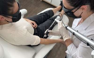 Debunking Common Myths About Laser Tattoo Removal