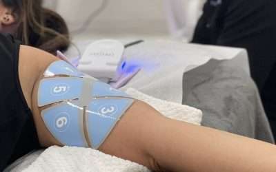 How Does FlexSure Radiofrequency Body Contouring Work?