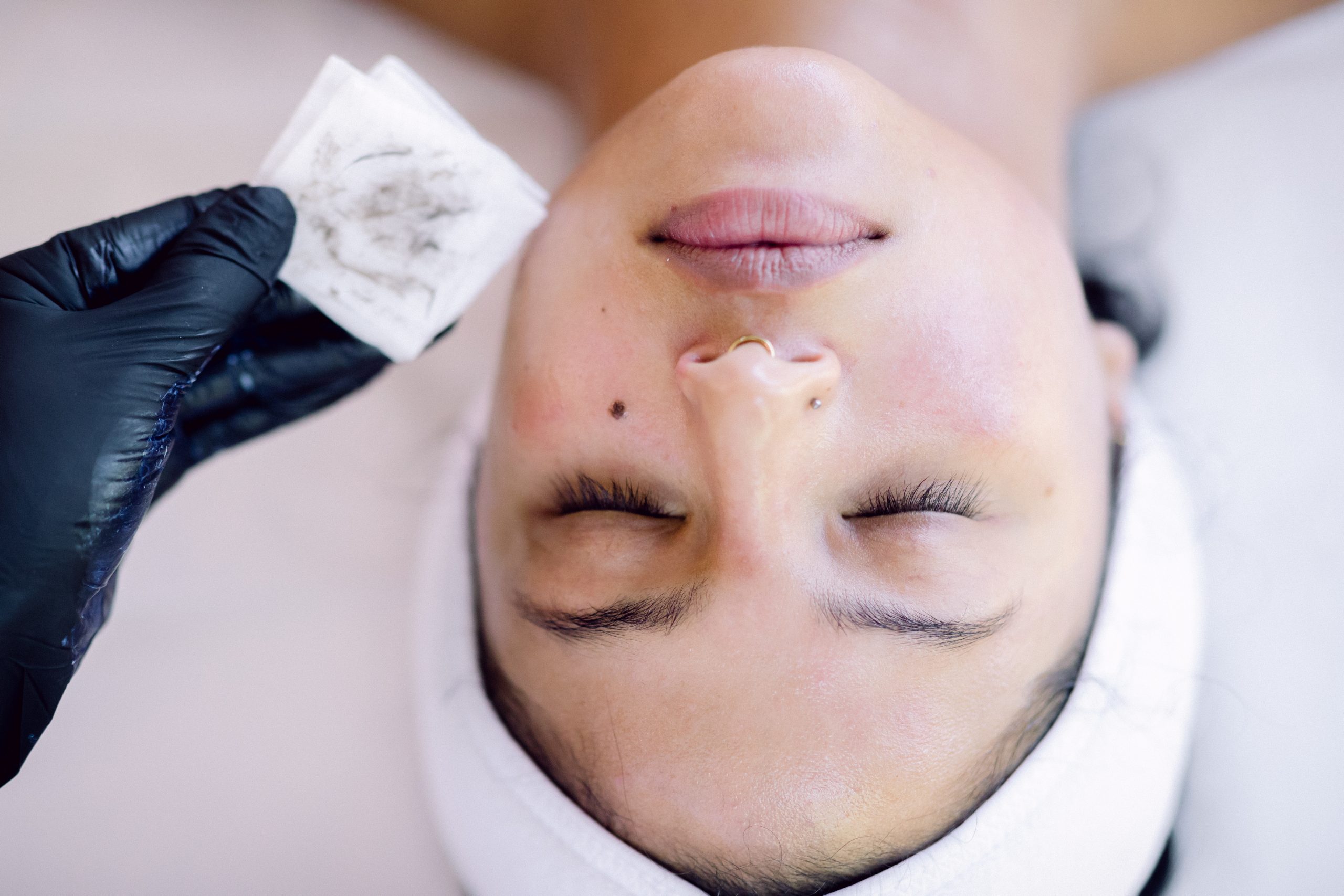 dermaplaning facial winnipeg dermaplaning facial dead skin on cotton pad