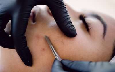 Dermaplaning: Explore the Power of this Celebrity-Approved Exfoliation Treatment