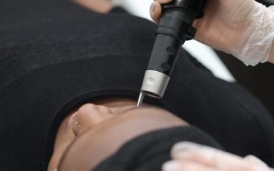 Passionate About Laser and RF Treatments? This is a Must-Read for You.