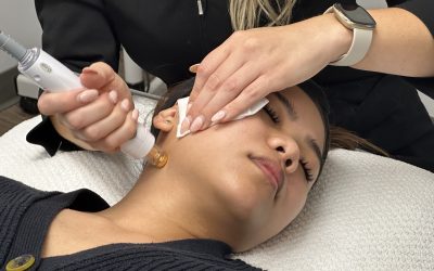 Skin Tightening in Winnipeg: How does it work?
