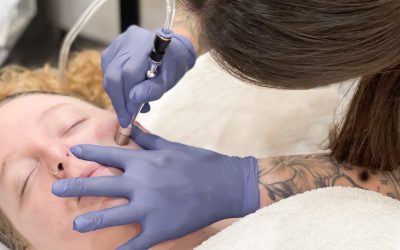 4 Best Facials to Pair with Microdermabrasion