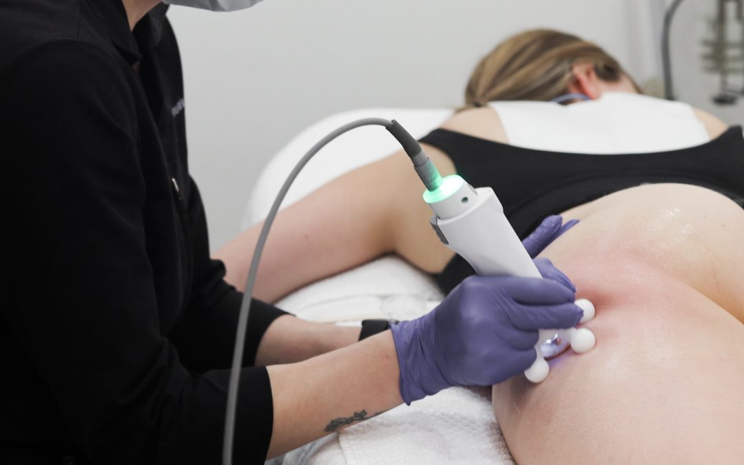 Woman receiving a radiofrequency treatment on her thighs.