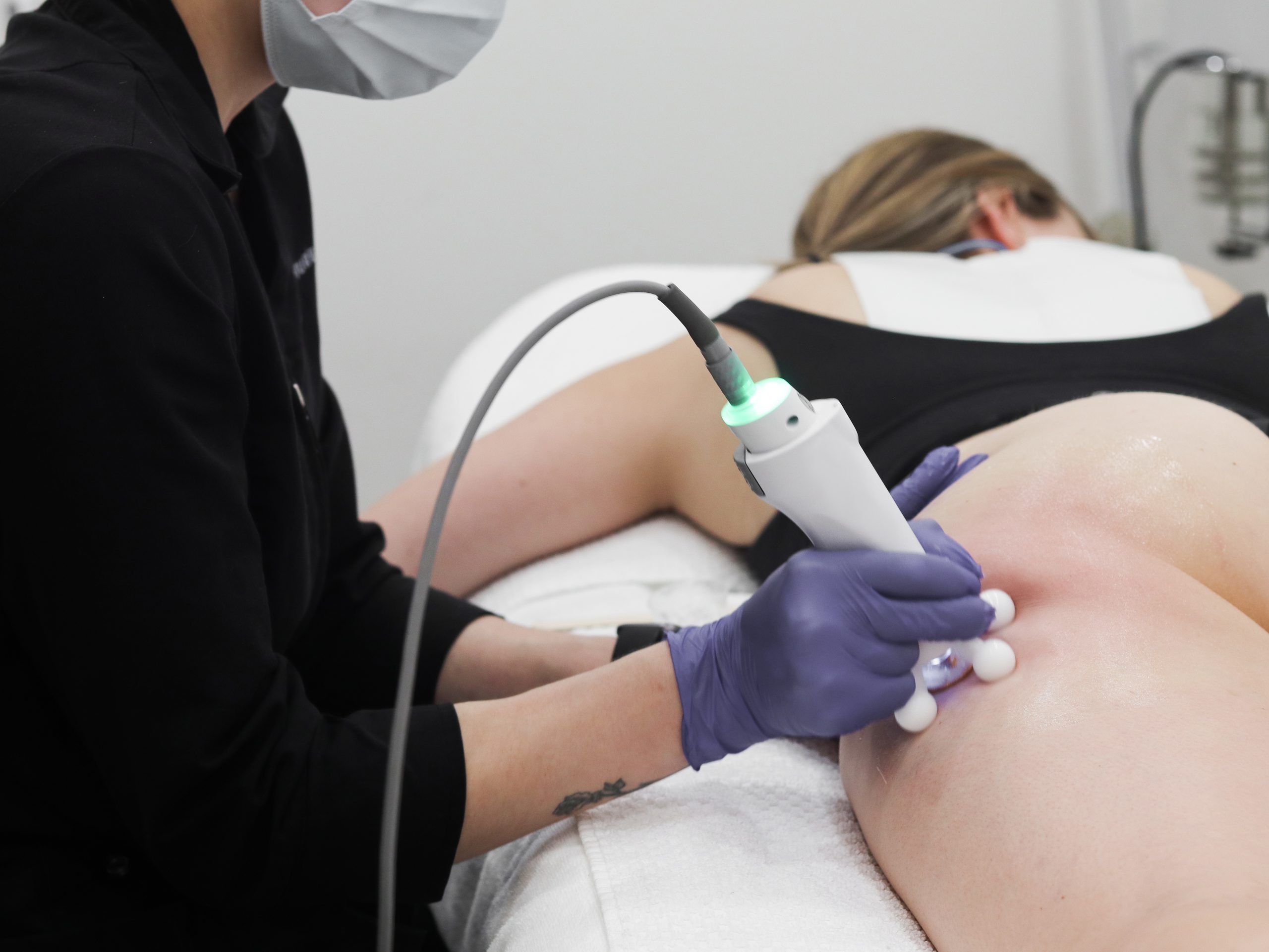 TempSure RF cellulite treatment winnipeg Winnipeg Skin Clinic - Woman receiving a radiofrequency treatment on her thighs.