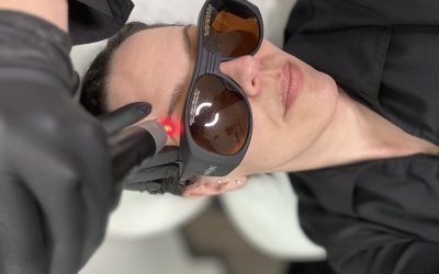Microblading Removal in Winnipeg: 10 Things You Should Know