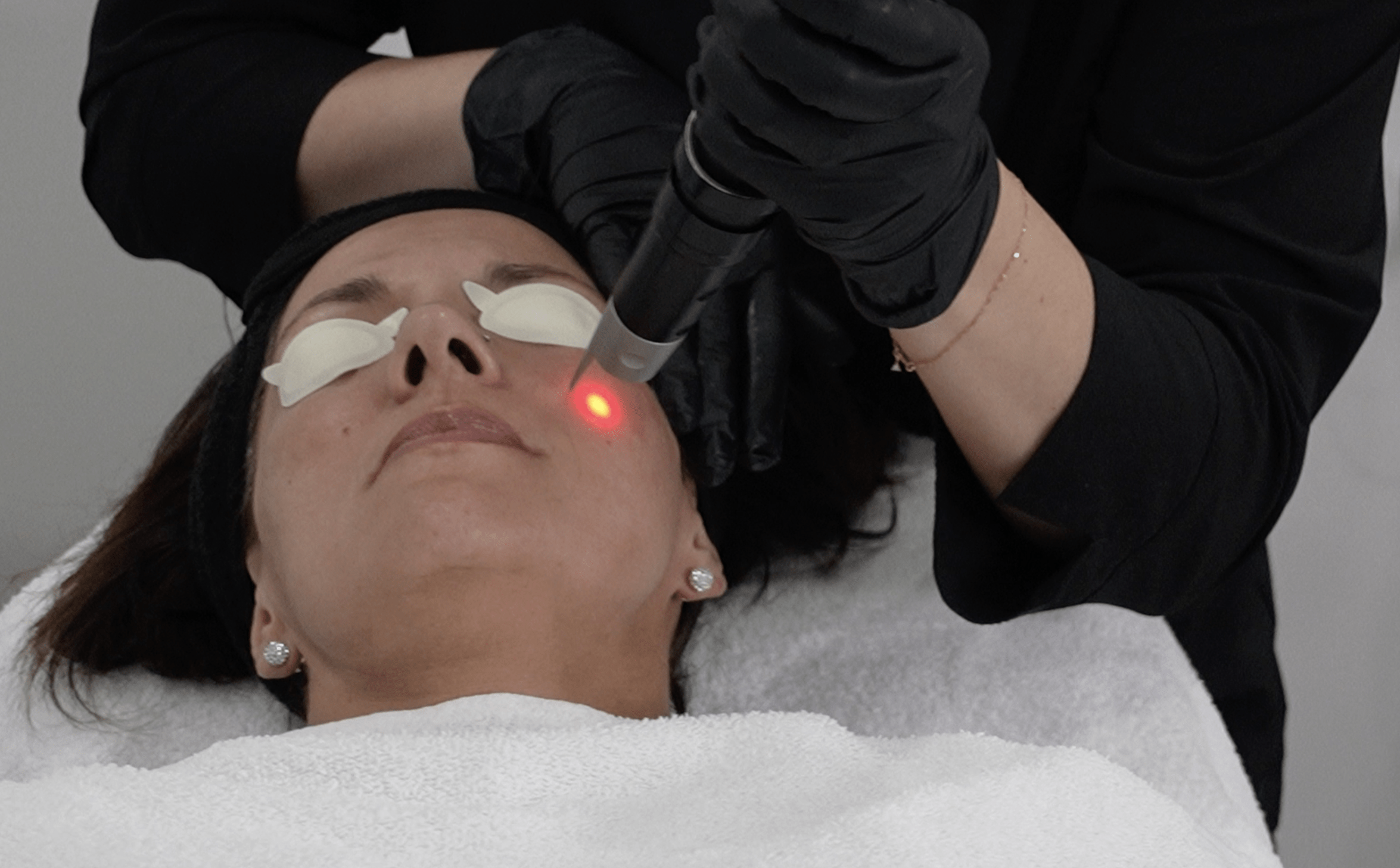 picosure laser treatment laser treatments to help the skin rejuvenate itself and look younger