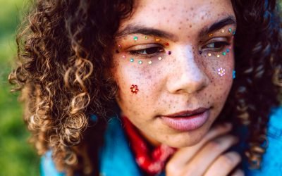 Am I Prone to Post-Inflammatory Hyperpigmentation?