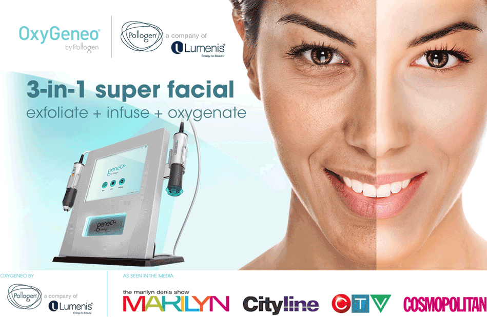 Oxygeneo Super Facial An ad for Oxygeneo showing the machine and a half-treated face