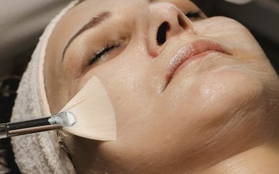 How to Prepare for Your First Chemical Peel in Winnipeg
