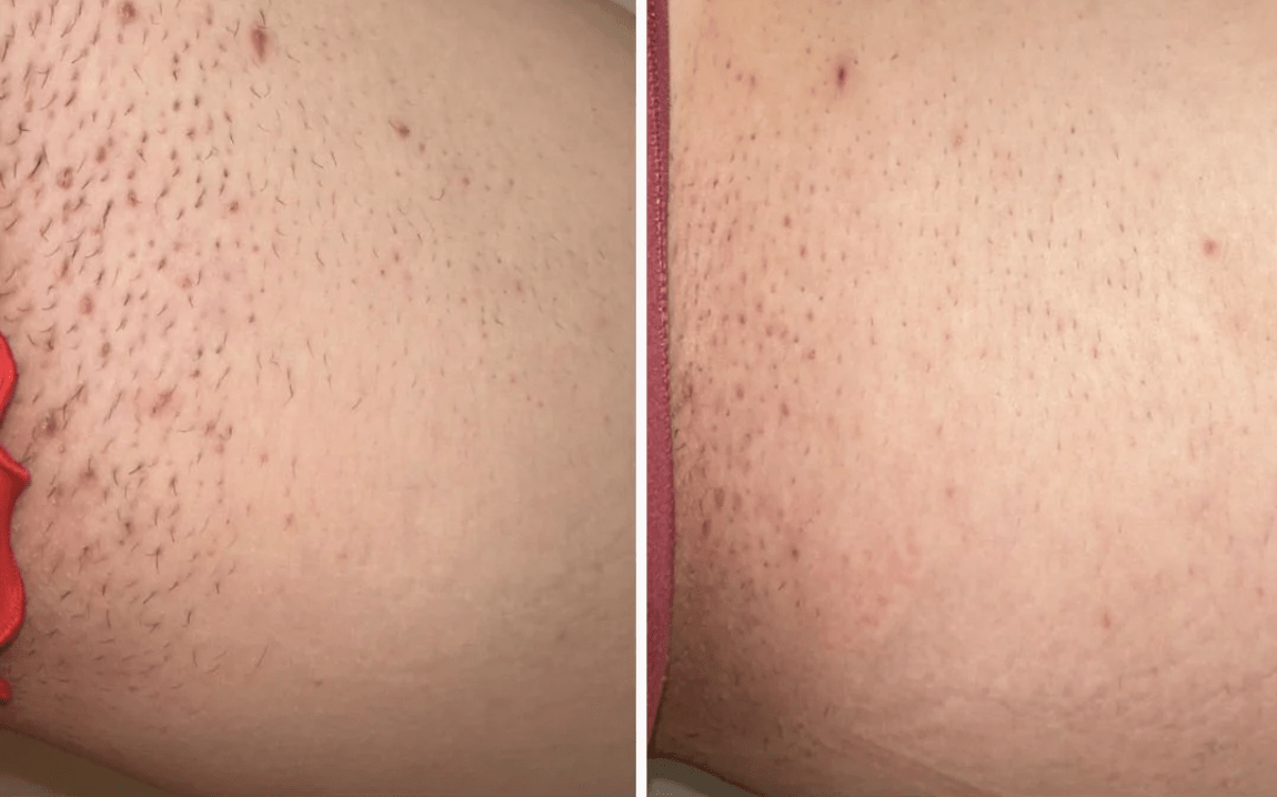 skin care results of using bush balm products