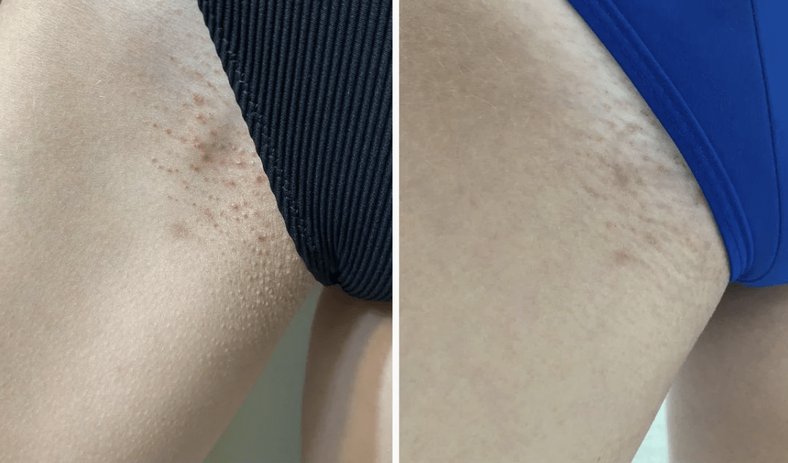 Side-by-side comparison of skin before and after using Bush Balm skincare products, showing smoother, more hydrated, and even-toned skin with reduced redness and irritation.