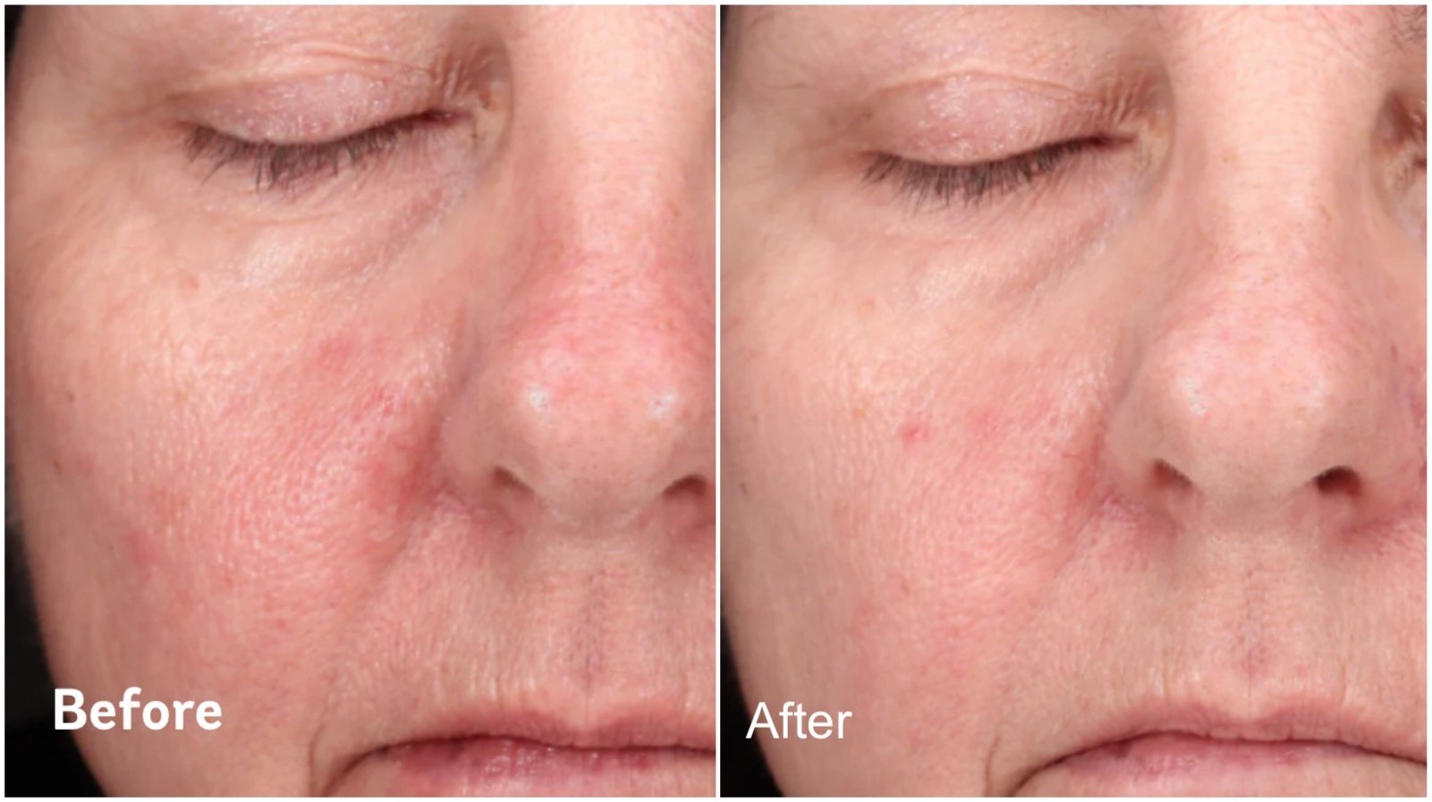 Creme 47 before and after results on skin of using creme 47
