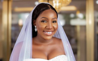 What Your Laser Timeline Should Look Like for a Wedding | Laser Facial in Winnipeg