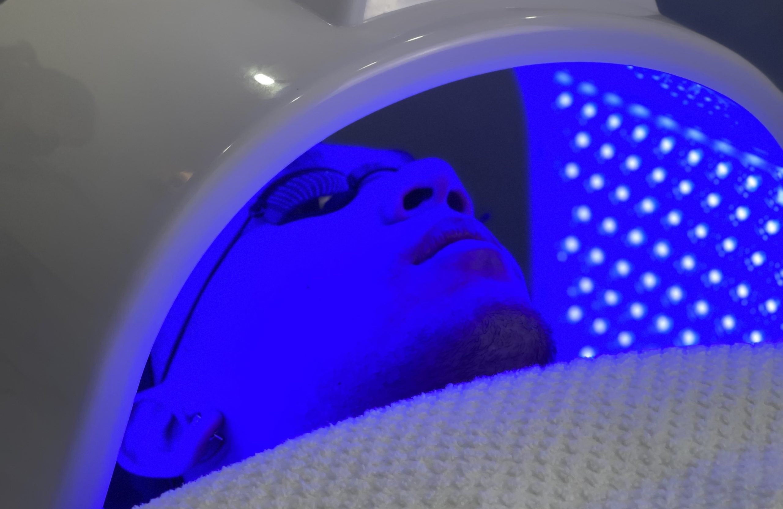 anti acne blue light therapy blue led light therapy on a man for Acne & Bacteria Control