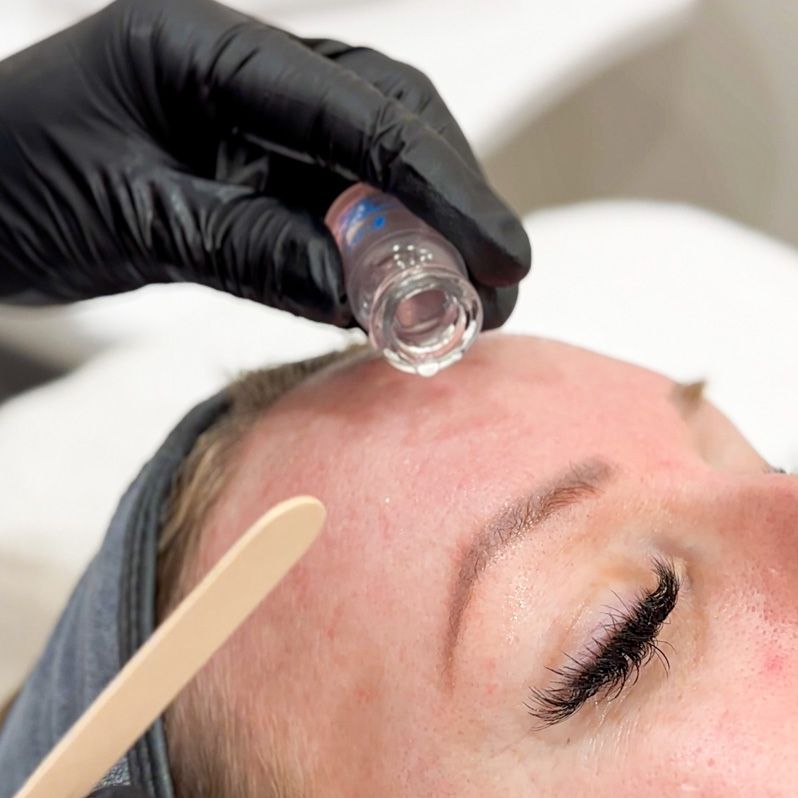 facial treatment in progress as part of an exosome facial in Winnipeg with advanced skincare technology