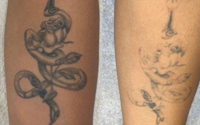 From YOLO to FOMO: The Evolution of Your Tattoo Regrets