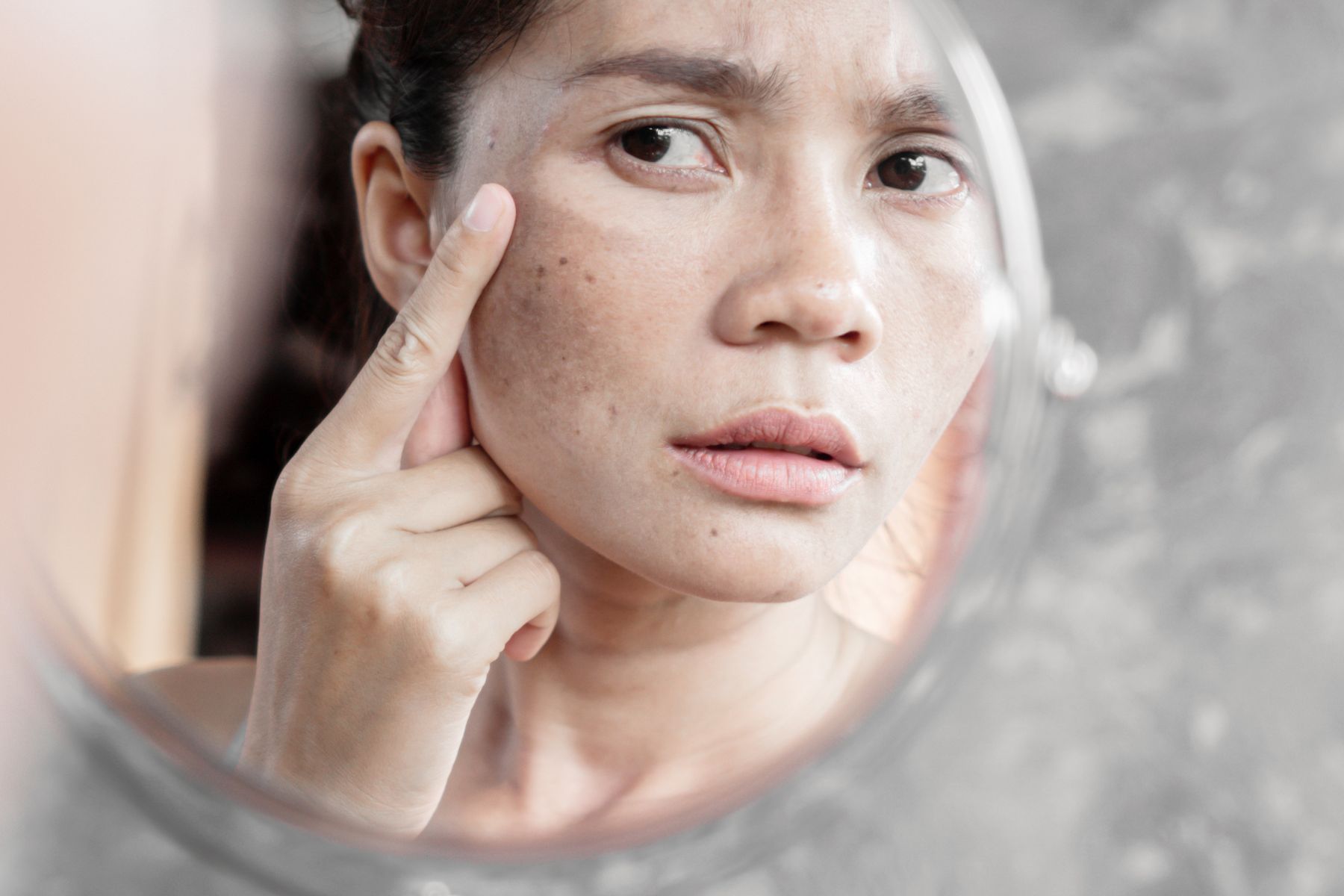 Woman looking into a mirror and pointing to dark spots and hyperpigmentation on her cheek, illustrating post-summer sun damage for “How to Fix Your Skin After Summer.”