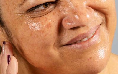 How Do I Stop My Skin From Being So Oily?